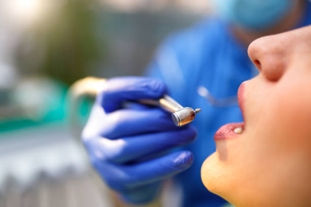 Dental Inlays and Onlays in Severna Park, MD